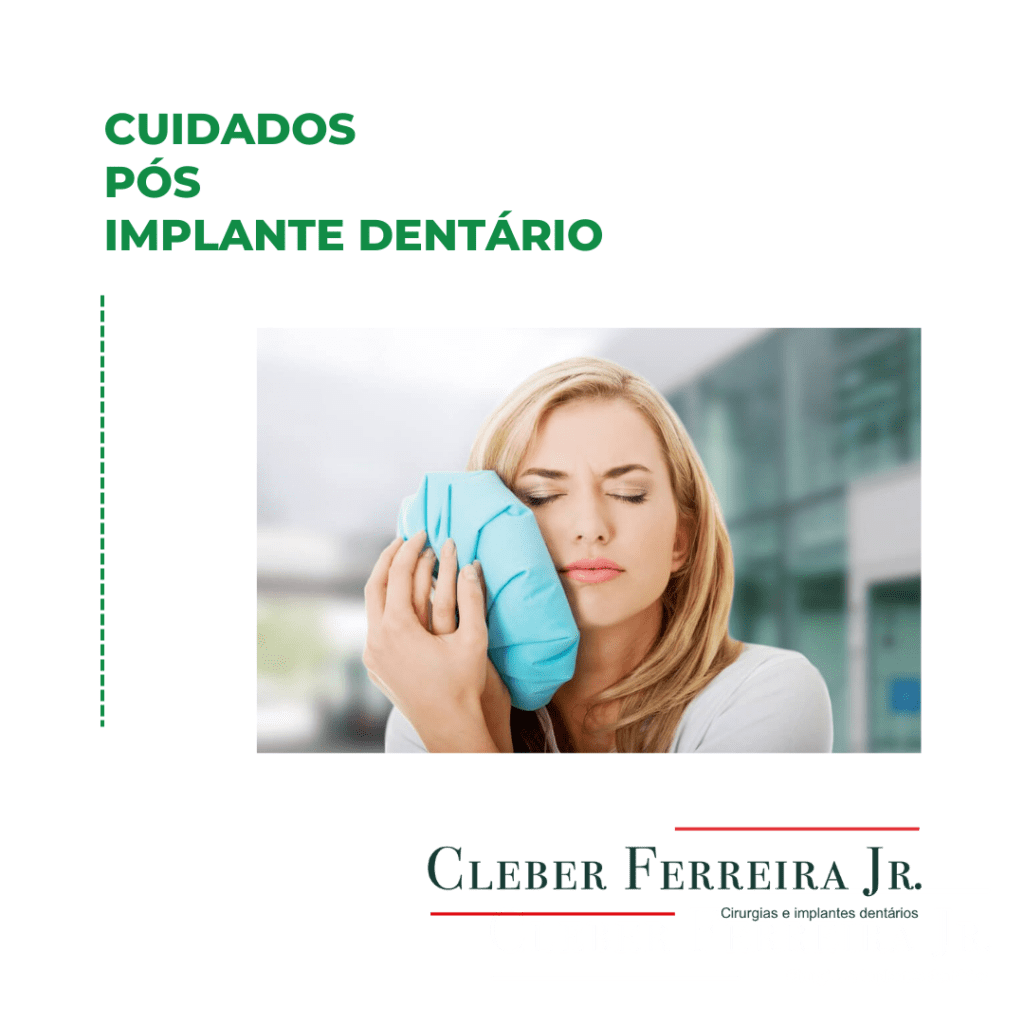 Cuidados pós-implante: dicas e recomendações para&nbsp;pacientes.